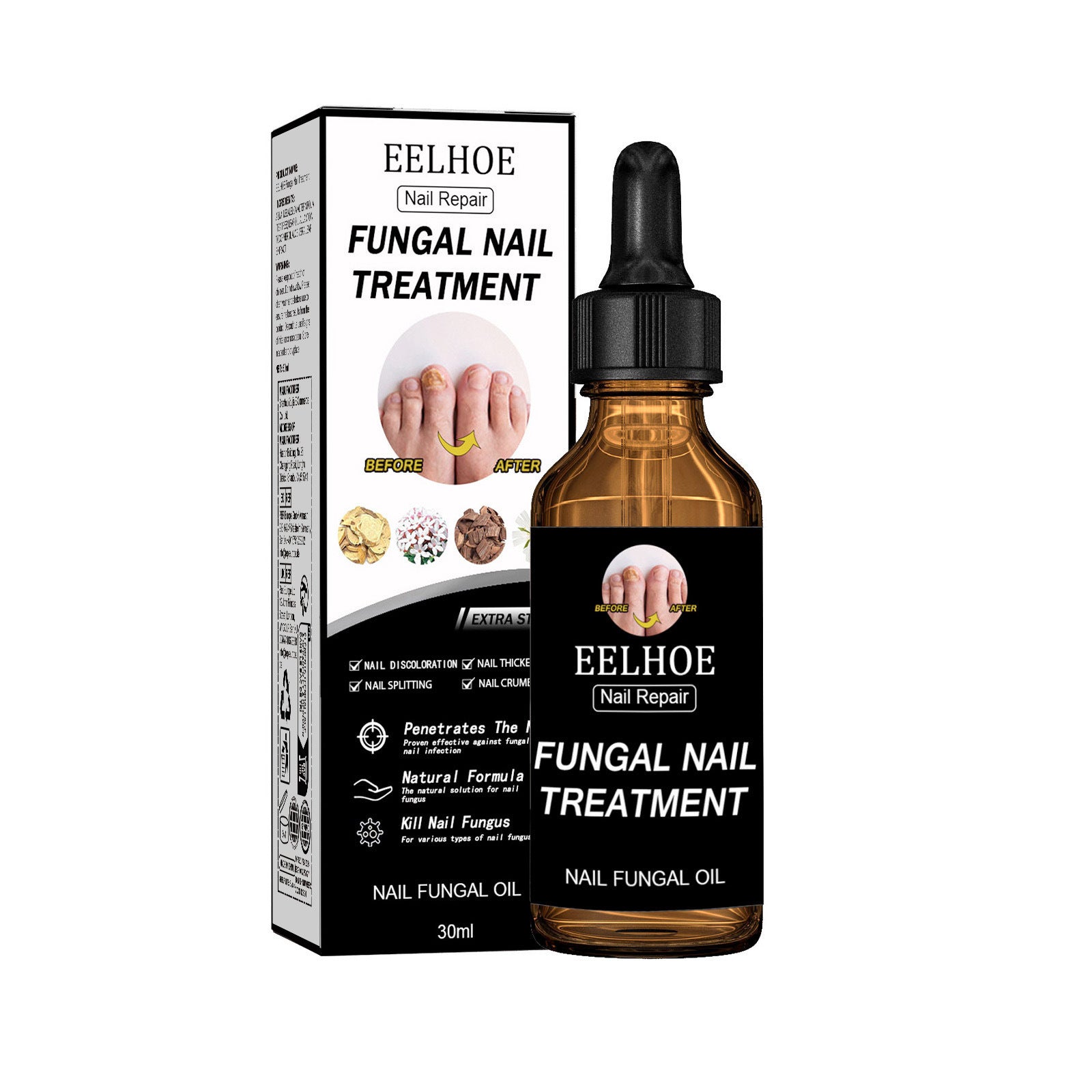 Fungal Nail Treatment