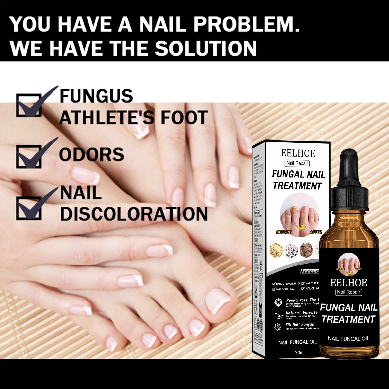 Fungal Nail Treatment
