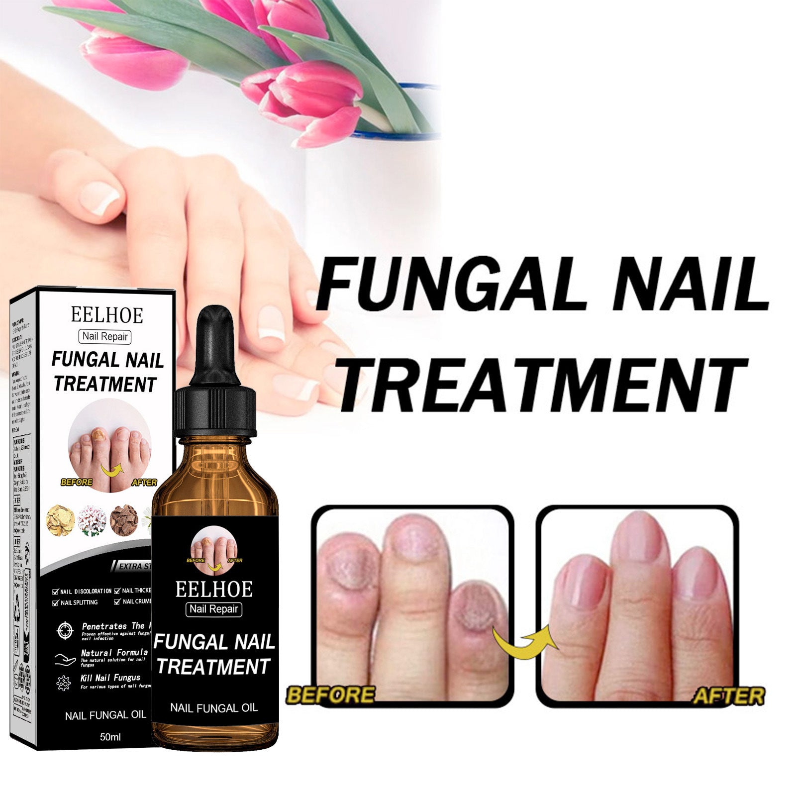 Fungal Nail Treatment