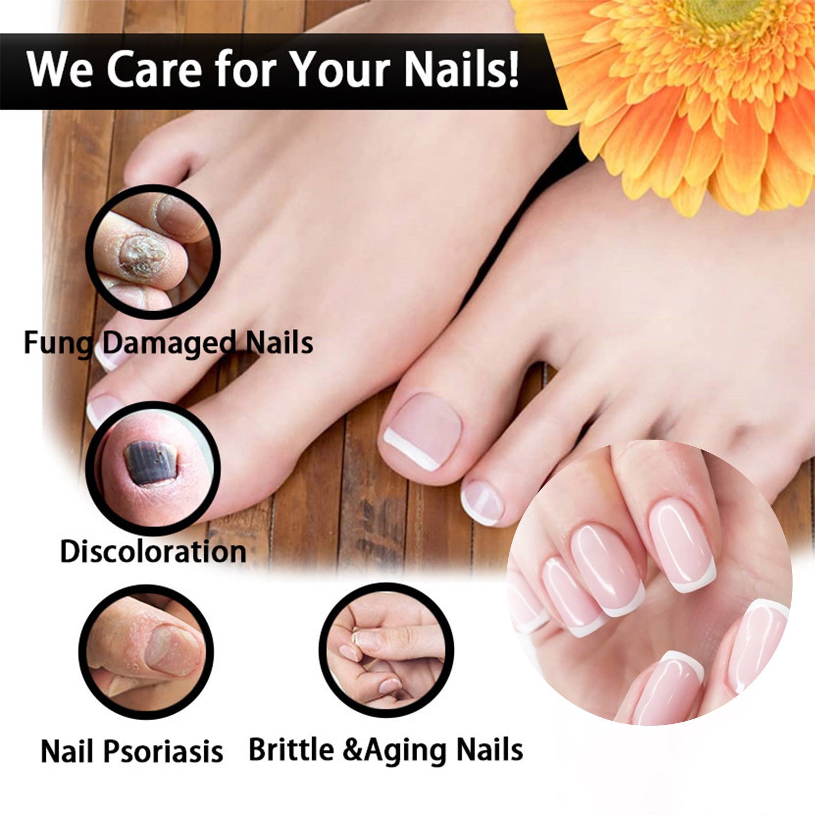 Fungal Nail Treatment
